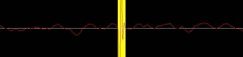 A vinyl waveform including a scratch loaded into digital sound editing software