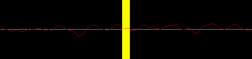 A vinyl waveform including a scratch which has been removed by interpolation loaded into digital sound editing software
