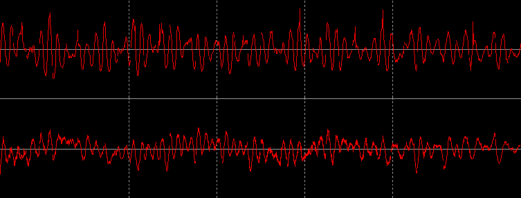 A vinyl waveform including several small scratches loaded into digital sound editing software