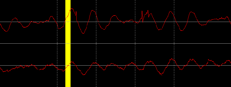 A vinyl waveform including several small scratches loaded into digital sound editing software